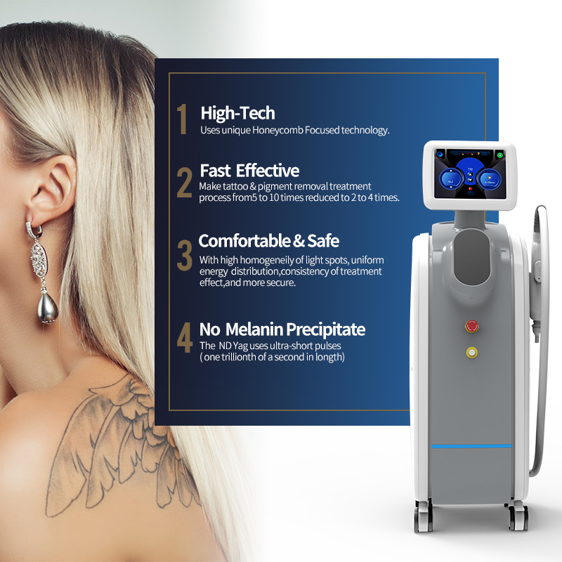 What is Q-switched Nd:YAG laser and how can it improve your skin?